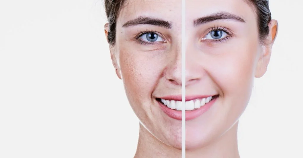 how to reverse aging face with Paleo diet